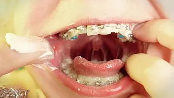 Play Eating in braces - close up video - food fetish - mouth tour